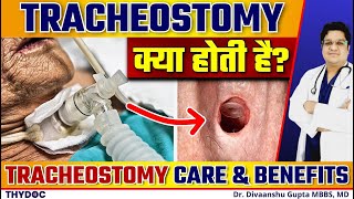 Tracheostomy क्या होती है  जानिए Tracheostomy के Benefits और Tracheostomy Care कैसे करें in Hindi [upl. by Trammel509]