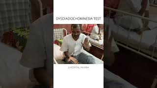 DYSDIADOCHOKINESIA TEST POSITIVE [upl. by Westberg]