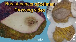 Breast cancer spceimen grossing video😨 museum specimen histo baby biopsy cancer breastcancer [upl. by Doownelg]