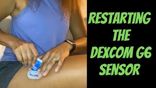 Restarting the Dexcom G6 sensor dexcomg6 [upl. by Ecnatsnok]