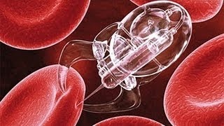 Nanotechnologie Dokumentarfilm Revolutioniert die Medizin und die Gesundheitspflege [upl. by Norraf]