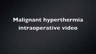 Malignant Hyperthermia Intraoperative video  Case Report [upl. by Tam133]