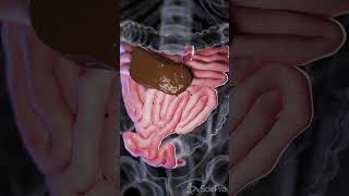 Understanding Small Bowel Perforation anatomy biology 3danimation [upl. by Suirtemed]