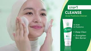 Acnes 3 Simple Steps to AcneFree Skin [upl. by Enaled]