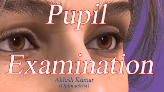 Pupil Examination  RAPD  Pupillary Light Reflex  Marcus Gunn Pupil  Swinging flashlight Test [upl. by Romine972]