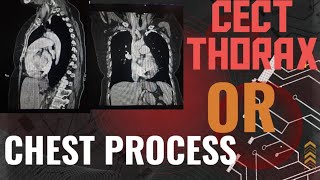 🫁 HOW TO DO CECT THORAXCHEST CONTRAST CT THORAX AXIAL SAGITTAL AND CORONAL📈 [upl. by Aicilegna]