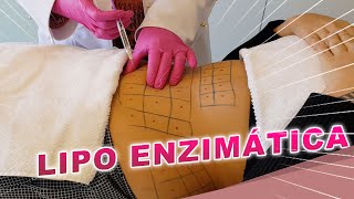 Resultados da Lipo Enzimática  Dr Luciane Bravi Explica [upl. by Emelin]