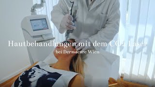 Hautbehandlungen mit dem CO2 Laser bei Dermacare Wien [upl. by Aramot154]