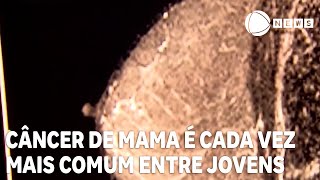 Câncer de mama é cada vez mais comum entre pessoas jovens [upl. by Rehctaht]