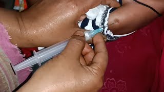 Child Cefepime 500mg Ultraprime amp Flucloxin injection Video 24 Ep 111 Injection Tips [upl. by Atinaj693]