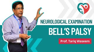 Bells Palsy  Neurological Examination by ProfTariqWaseem medical education medicalexamination [upl. by Wisnicki]