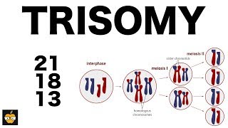 Trisomy 21 18 and 13 amp Nondisjunction Genetics [upl. by Talya669]