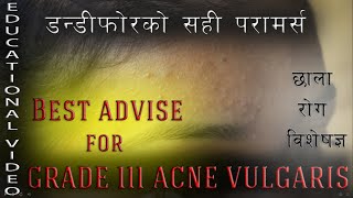 Dermatology  Best advice for Acne vulgaris  डन्डीफोर  Dr Prajwal Pandey  DIP Medical  नेपालीमा [upl. by Drofdarb]