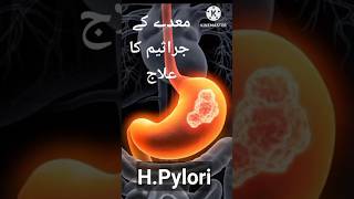 HPylori Helicobacter Pylori Signs Symptoms Lab Test and Treatment hpylori treatment shorts [upl. by Neelyhtak]