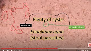 ParasitologyEndolomax E nana in stool sample under the microscope [upl. by Alveta503]