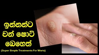 ඉන්නන් සුව කරන ඉතාම පහසු දේශීය ප්‍රතිකාර  Simple Sri Lankan Treatments For Warts [upl. by Ainezey]