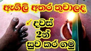 දියමැටියෝ කනවට මෙන්න බෙහෙතthuru tv [upl. by Takakura19]