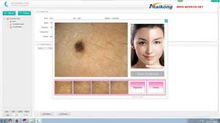 how to use the Maikong skin analyzer Skin Observed Systemskin analyzer [upl. by Colan477]