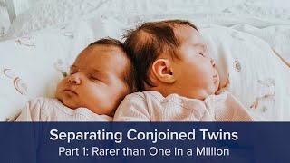 Separating Conjoined Twins Part 1 Rarer than One in a Million [upl. by Iroak885]