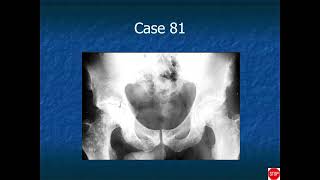 RADIOLOGY EXAM CASES [upl. by Knoll]