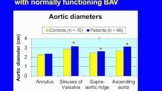 Bicuspid aortic valve Prevalence genetics and natural history [upl. by Deb836]