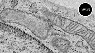 A new kind of mitochondria [upl. by Burdelle954]