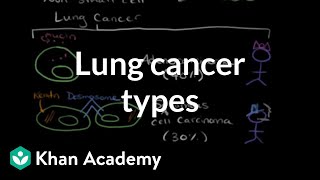 Lung cancer types  Respiratory system diseases  NCLEXRN  Khan Academy [upl. by Chuu]