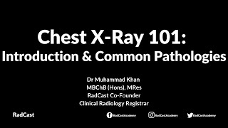 RadCast Academy Introduction To The Chest XRay amp Common Pathologies cxr radcast [upl. by Hackett656]