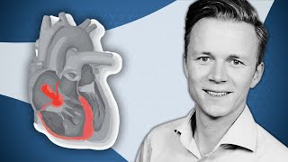 Hemodynamic diagnosis of tricuspid regurgitationright heart failure  PCR Tricuspid Focus Group [upl. by Nmutua]