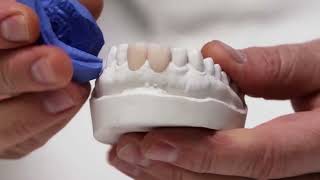 Dental Lab Procedure for Provisional Crown Restoration  TEASER VIDEO [upl. by Aidyl836]