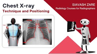 Chest Xray PA Technique and Positioning [upl. by Adnilasor145]