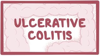 Ulcerative colitis  causes symptoms diagnosis treatment pathology [upl. by Simonne522]