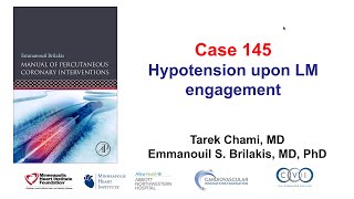 Case 145 PCI Manual  Hypotension after left main engagement [upl. by Enait386]