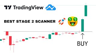 The ONLY TradingView scanner youll ever need [upl. by Ayaet241]