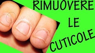 COME RIMUOVERE LE CUTICOLE Sos unghie 9 [upl. by Aidnyl256]