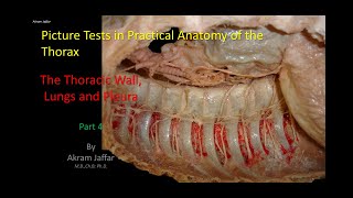 Picture Tests in Anatomy  Thorax  Wall and Lung 4 [upl. by Clementi]