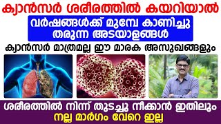 ക്യാൻസർ ശരീരത്തിൽ കഴറിയാൽവർഷങ്ങൾക്ക് മുമ്പേ കാണിച്ചു തരുന്ന അടയാളങ്ങൾ Dr Shimji Symptoms of cancer [upl. by Neeluj]