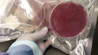 Microbiology Propionibacterium acnes anaerobic set up and colonial growth [upl. by Haleigh]