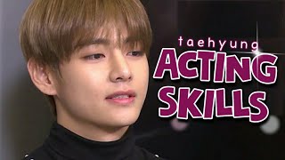 Kim Taehyungs Brilliant Acting Skills  Oscar Worthy Acting [upl. by Ignatzia287]