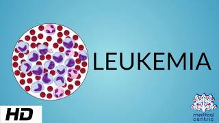 LEUKEMIA Causes Signs and Symptoms Diagnosis and Treatment [upl. by Giule]