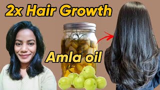 I Tried AMLA OIL for 60 Days  Before and After results 😱 [upl. by Baptiste]