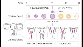 Amenorrhea  Definition Causes Signs and Symptoms Investigation and Management [upl. by Nosille956]