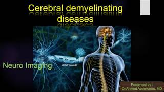 9cerebral demylinating diseases [upl. by Nola]