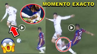 Video completo Lesión de Hobbit Bermúdez Atlante vs Dorados ESTO PASO momento exacto Hobbit Bermúdez [upl. by Mischa]