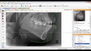 Orisceph StepbyStep [upl. by Eicyal]