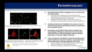 Indications Cervical Spondylotic Myelopathy  Benjamin Kafka MD [upl. by Sackman]