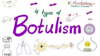 Four Types of Botulism  Foodborne botulism Infant botulism Wound botulism amp Inhalation botulism [upl. by Hank931]