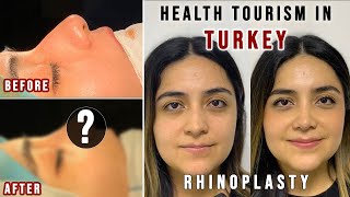 Rhinoplasty in Turkey  FULL EXPERIENCE  Affordable and Good Quality HEALTH TOURISM IN TURKEY [upl. by Eidnahs]