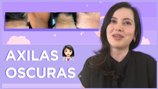 🥲¿Axilas oscuras Tips para cuidarlas [upl. by Attenor]