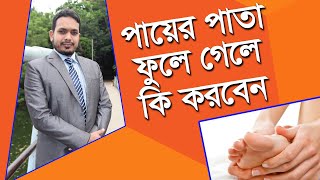 পায়ের পাতা ফুলে যাওয়ার কারণ ও ঘরোয়া চিকিৎসা Leg pain [upl. by Enibas]